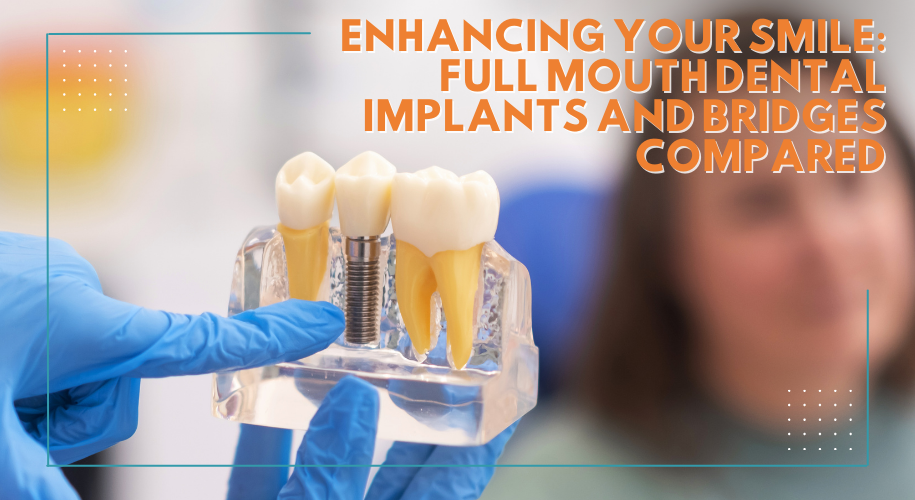 Enhancing Your Smile: Full Mouth Dental Implants and Bridges Compared