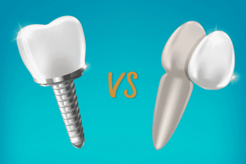 different types of teeth