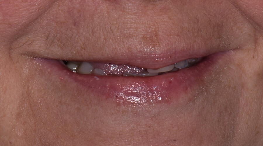 Case 1 Before