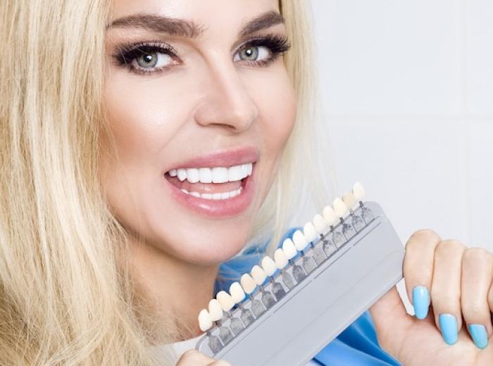 Bioclear: The Best Alternative To Traditional Veneers