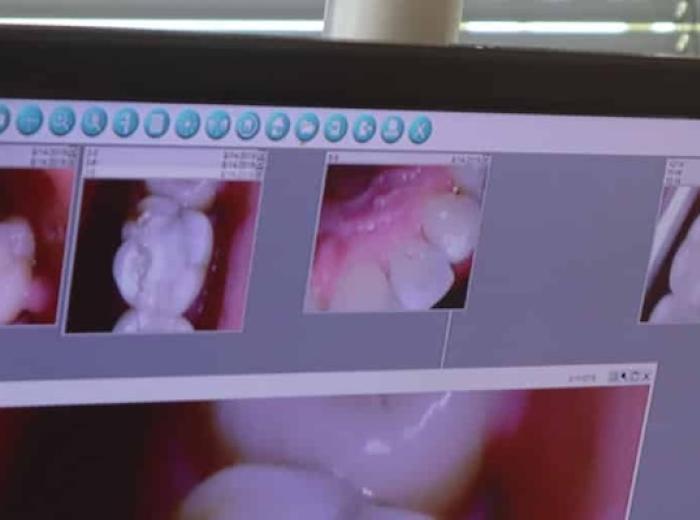 Everything To Know About Tooth Enamel