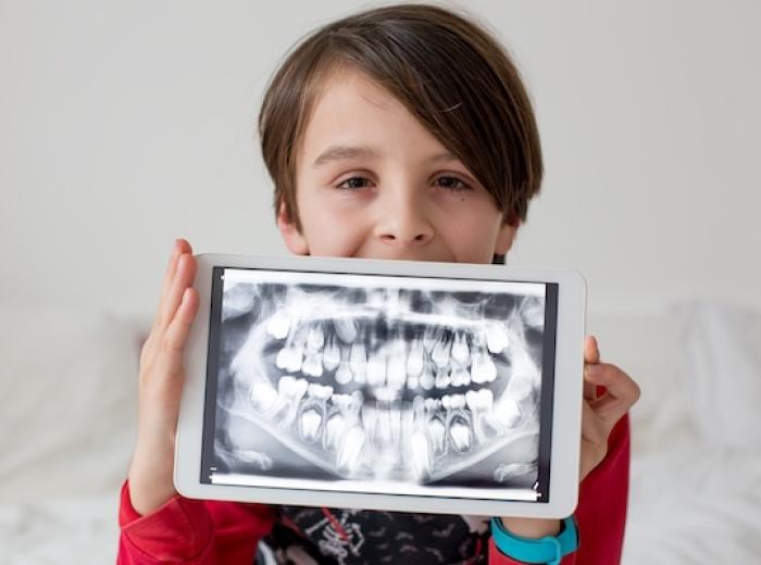 How Often Should X-Rays Be Taken?