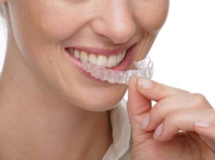 Can Adults Get Orthodontics?
