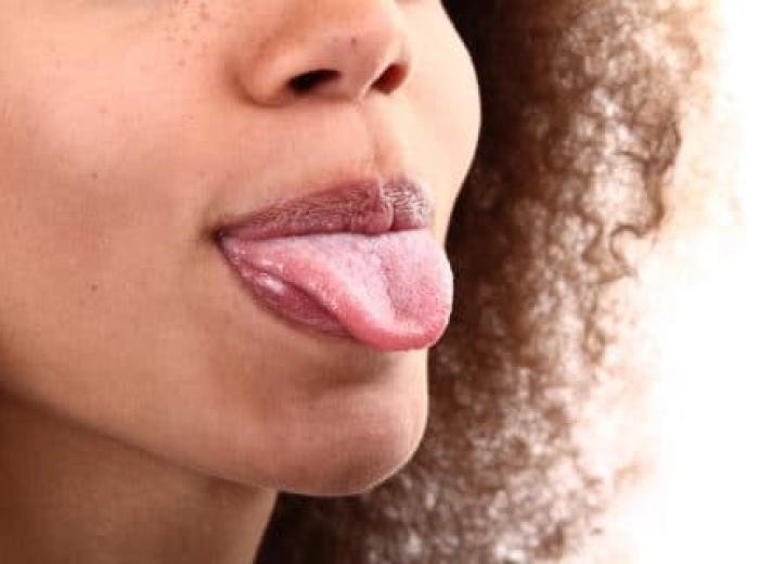 What Your Tongue Can Tell You About Your Health