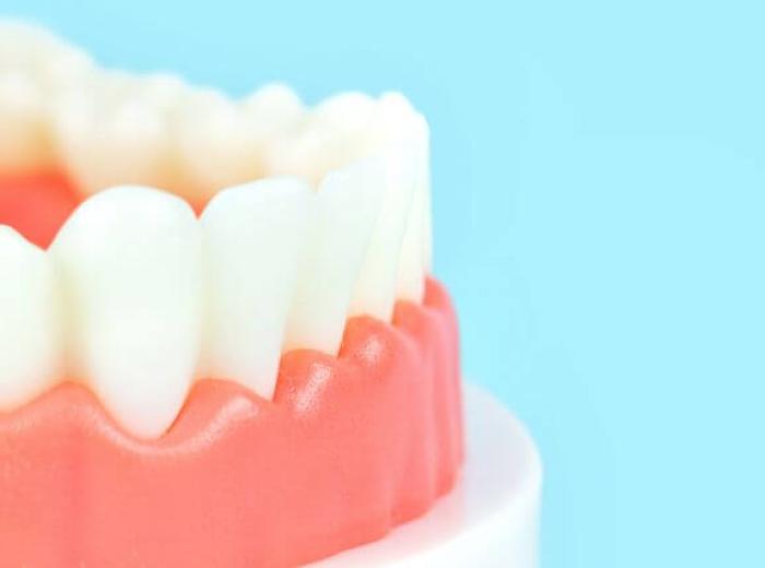 Your Path to Healthier Gums: Understanding Pocket Reduction Surgery